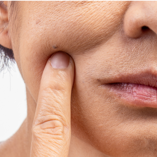 Barrier Repair 101: Why Your Skin is Dry, Red, and Angry (and How to Fix It)